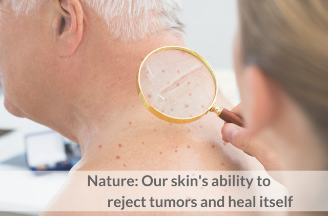 Nature: Our skin's ability to reject tumors and heal itself